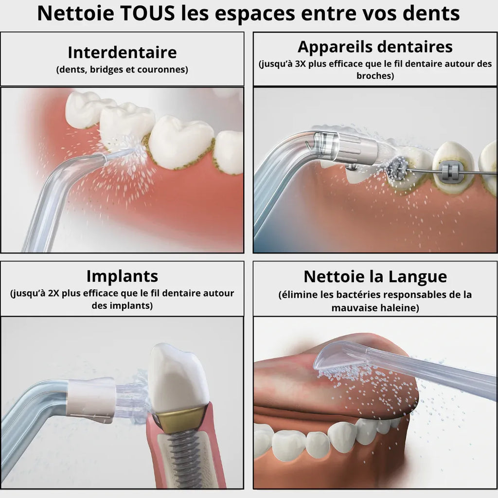 HYDROPULSEUR DENTAIRE